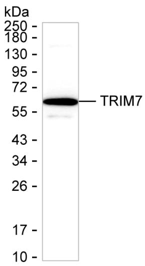 TRIM7